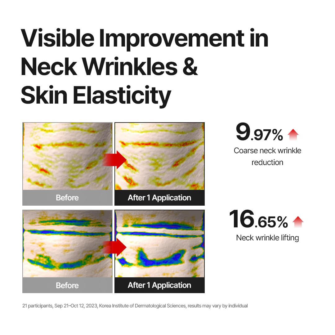 MDP+ Premium Collagen Naite Thread Neck Cream 2.0 | Skin Tightening, Firming, 3.38oz/100ml, Anti-Aging, Moisturizer Face Cream, Neck & Décolleté Wrinkles, Soft Smooth Skin - MDP Official Product View 8