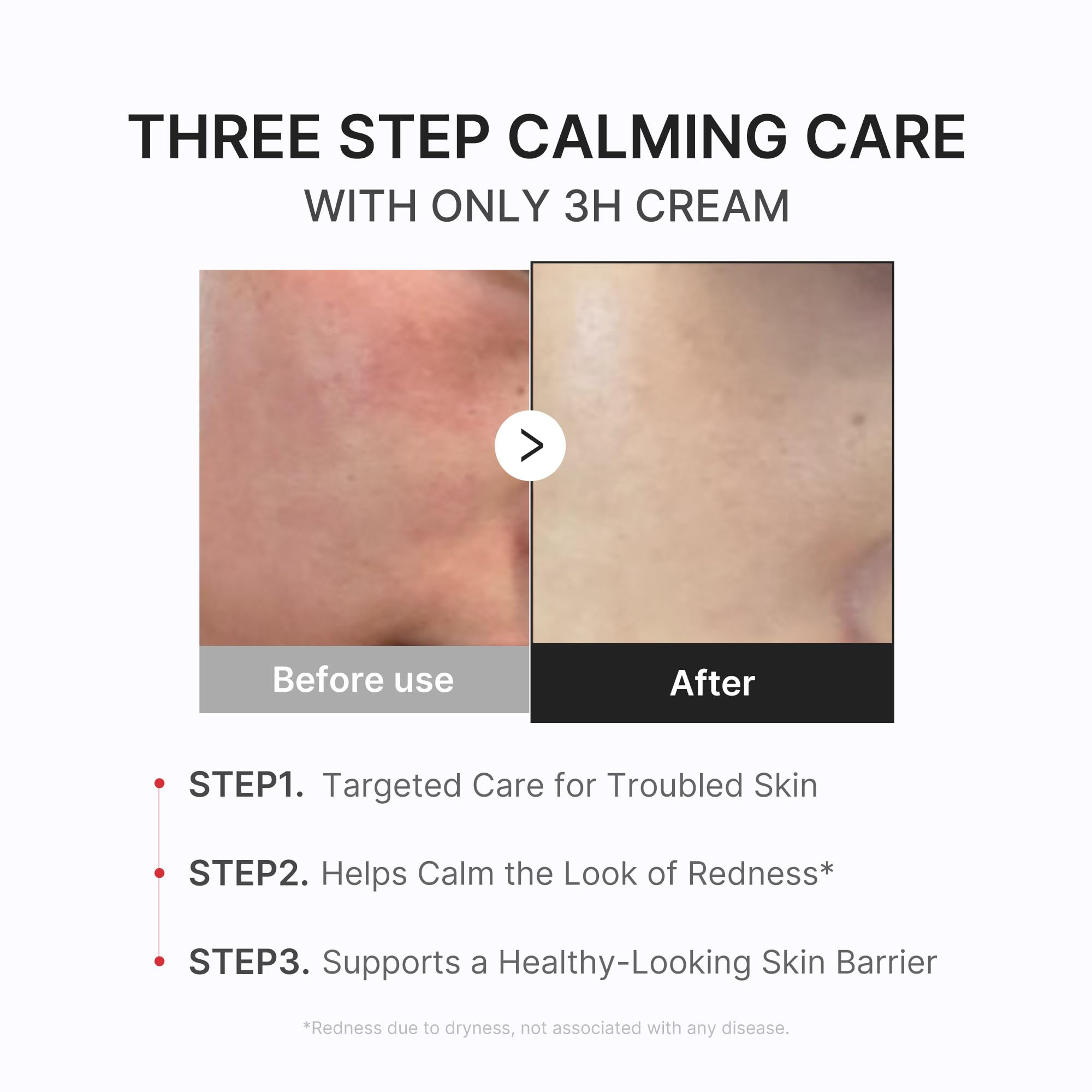 medicube Clarifying Pad & Soothing Cream Duo - medicube Official Product View 7