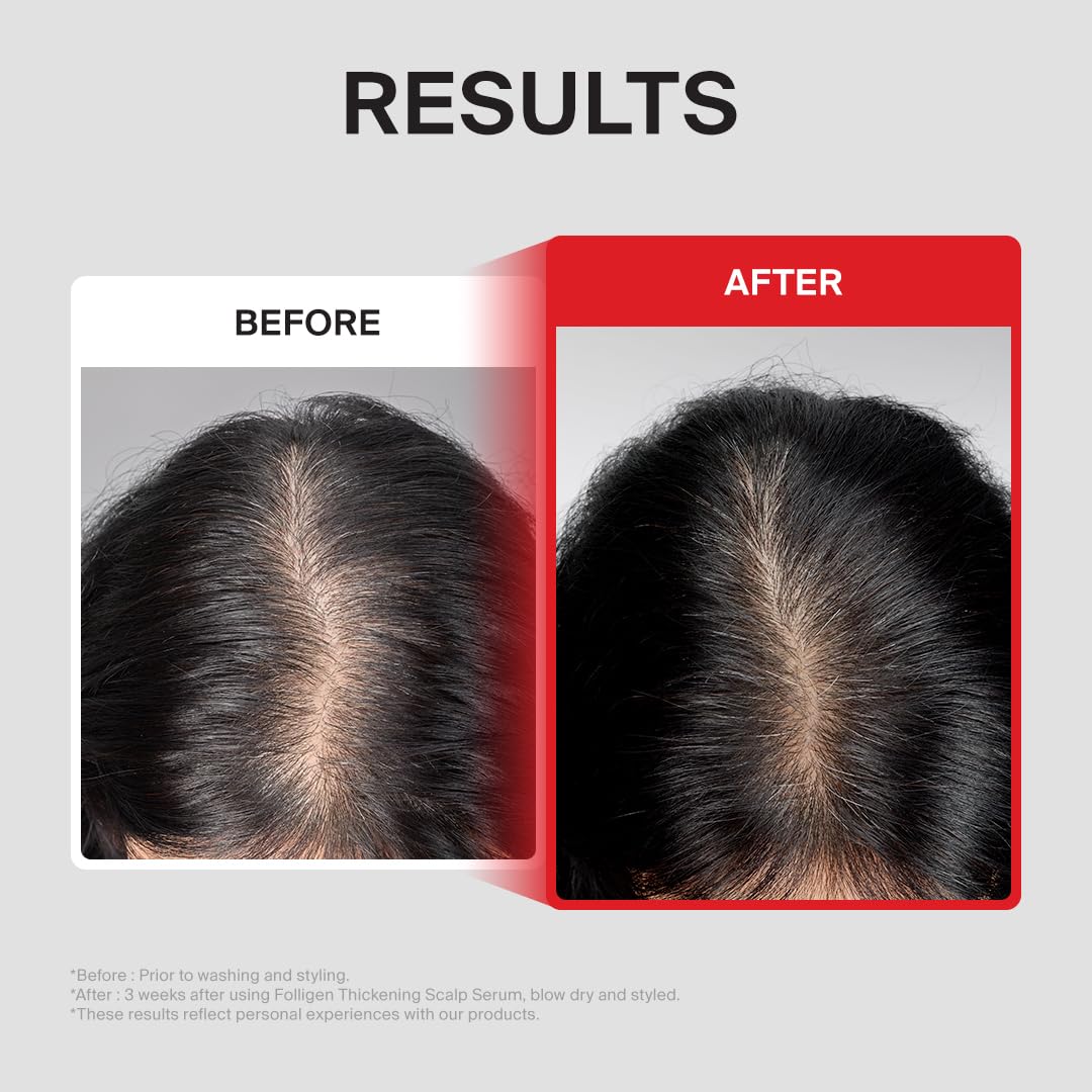 Dr FORHAIR Folligen Thickening Scalp Serum 1 7 fl oz - DR.FORHAIR Official Imagery - 6