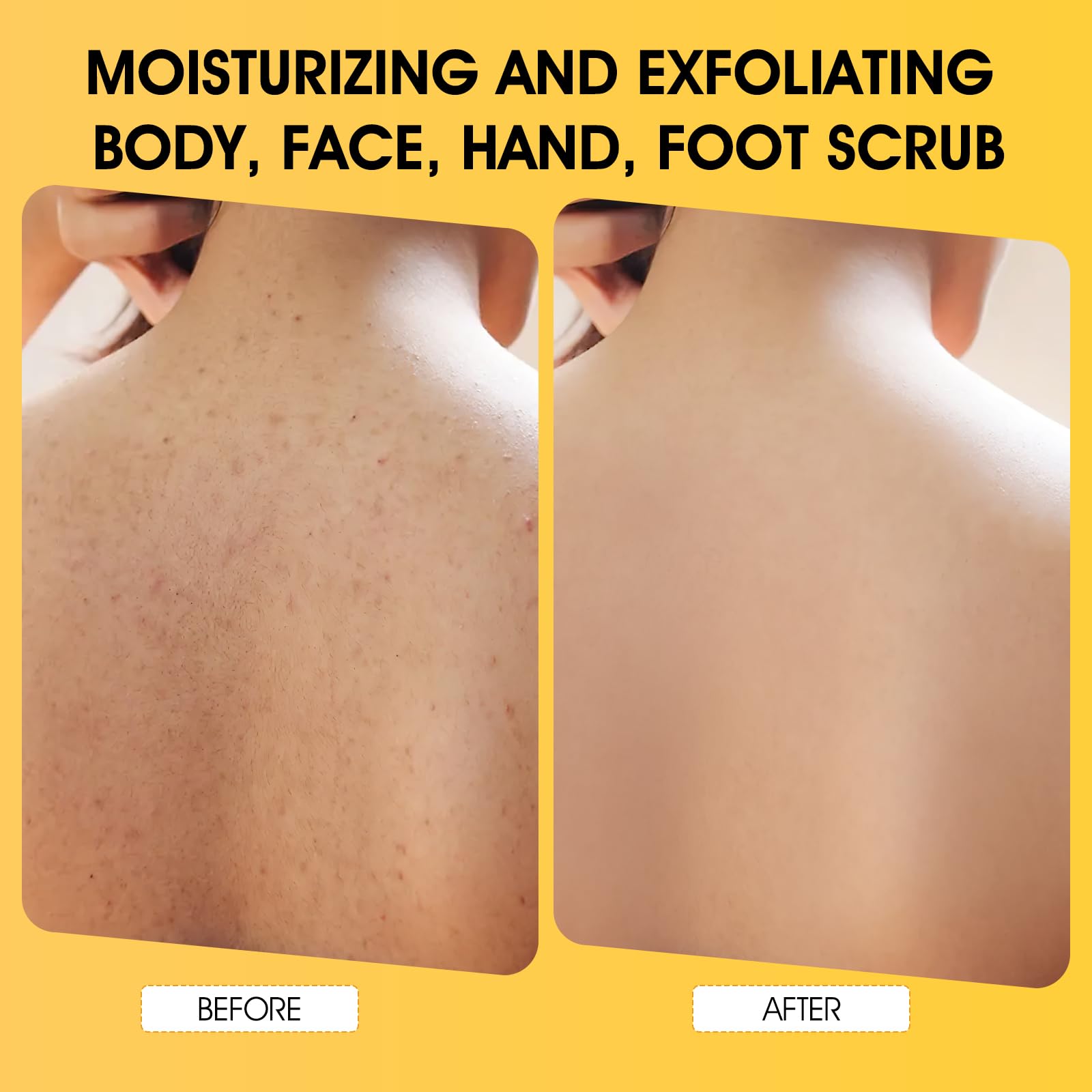 VOERUY Turmeric Body Scrub, 10% AHA - BHA & Vitamin C Exfoliating Body Scrub - VOERUY Official Product View 6