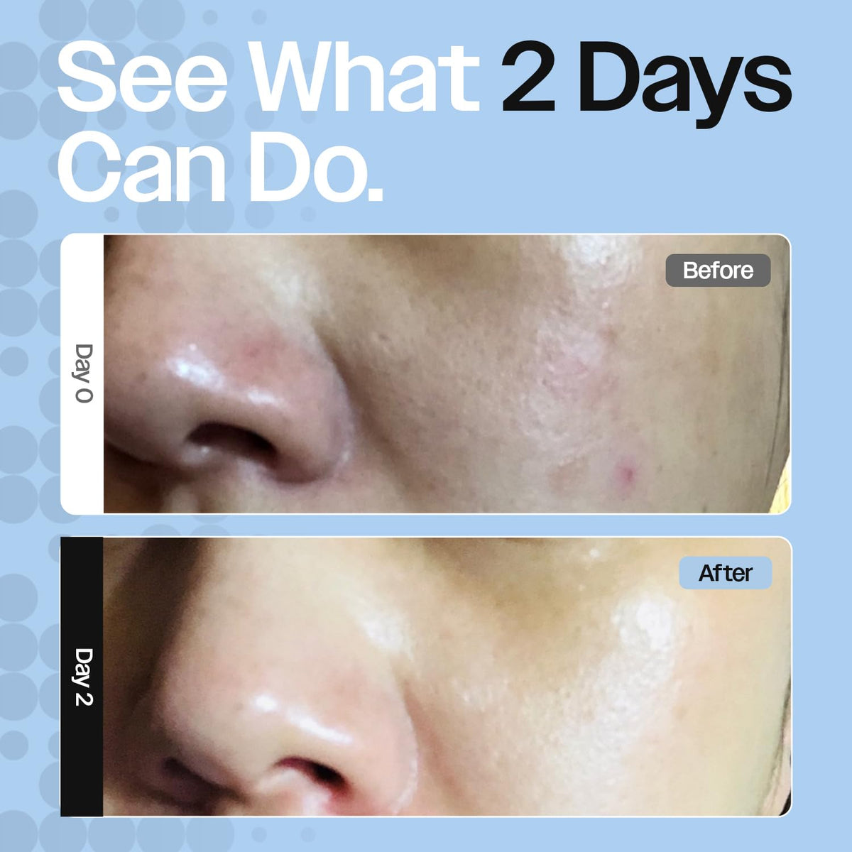 Barrier Repair Cream for Dry Sensitive Eczema Prone Skin - CELRIV Official Imagery - 6