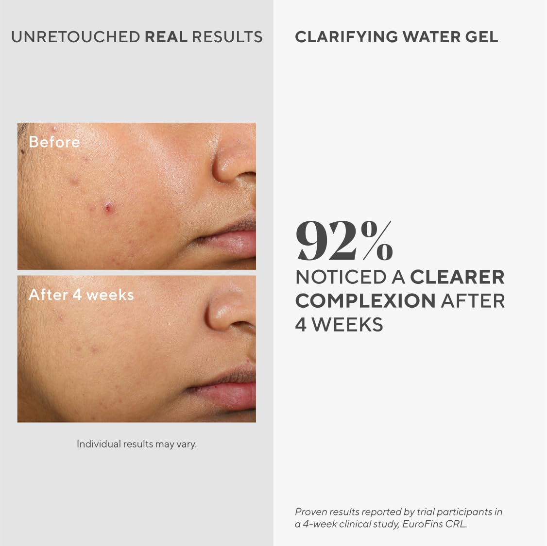 Murad Clarifying Water Gel - Premium Selection Official Imagery - 3