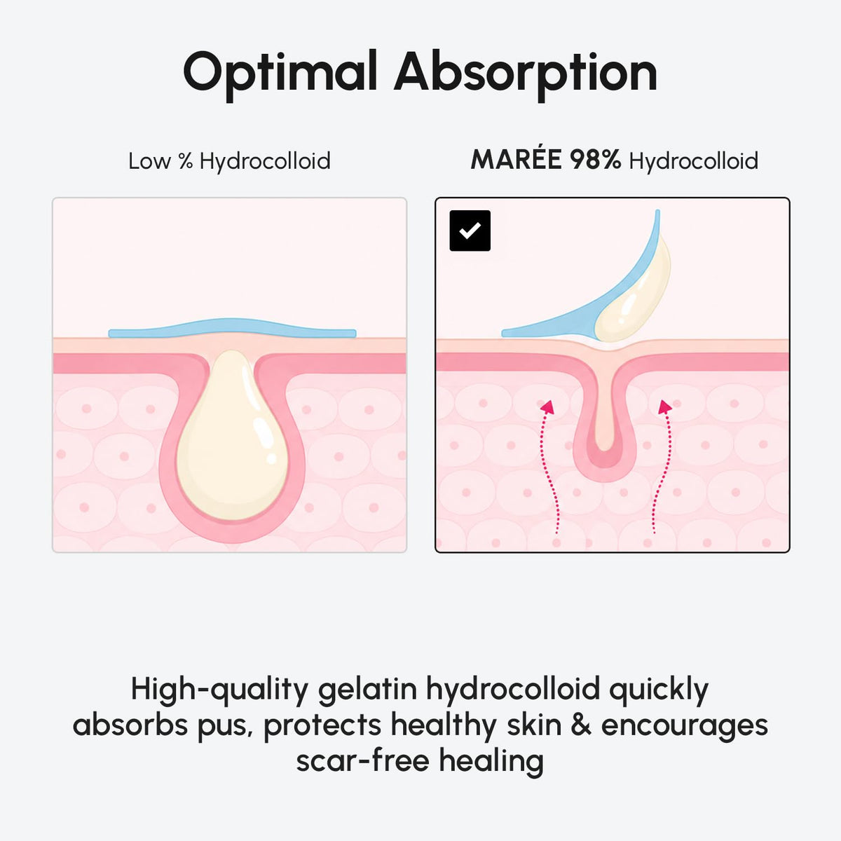 MAREE Invisible Pimple Patches 2Pk - MAREE Official Imagery - 6