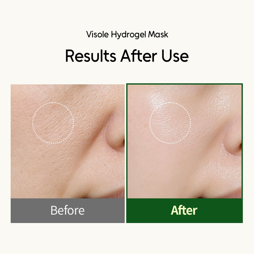 Hydrogel Face Mask 4 Pack - VISOLE