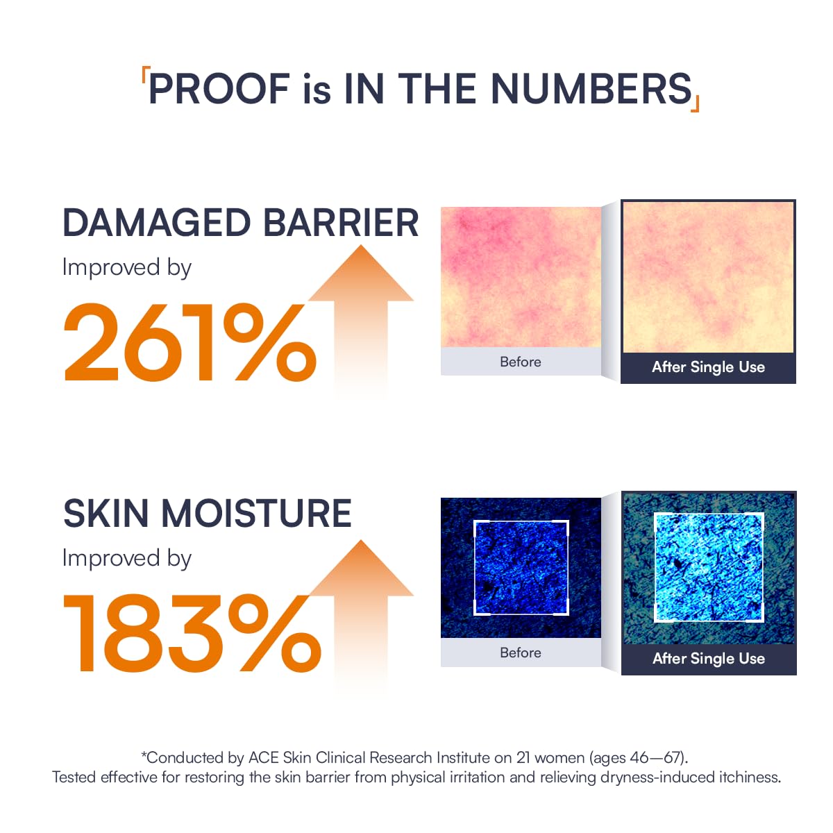 Abso BIO BAND REPAIR Cream Daily Post Treatment Skin Barrier - Abso. Official Imagery - 7