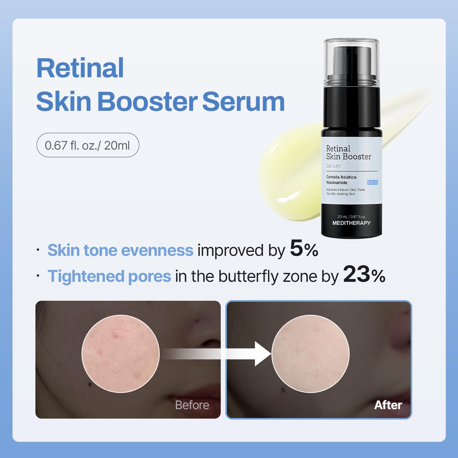 MEDITHERAPY Gentle Boost Kit – Korean Skin Care Set with Retinal - MEDITHERAPY