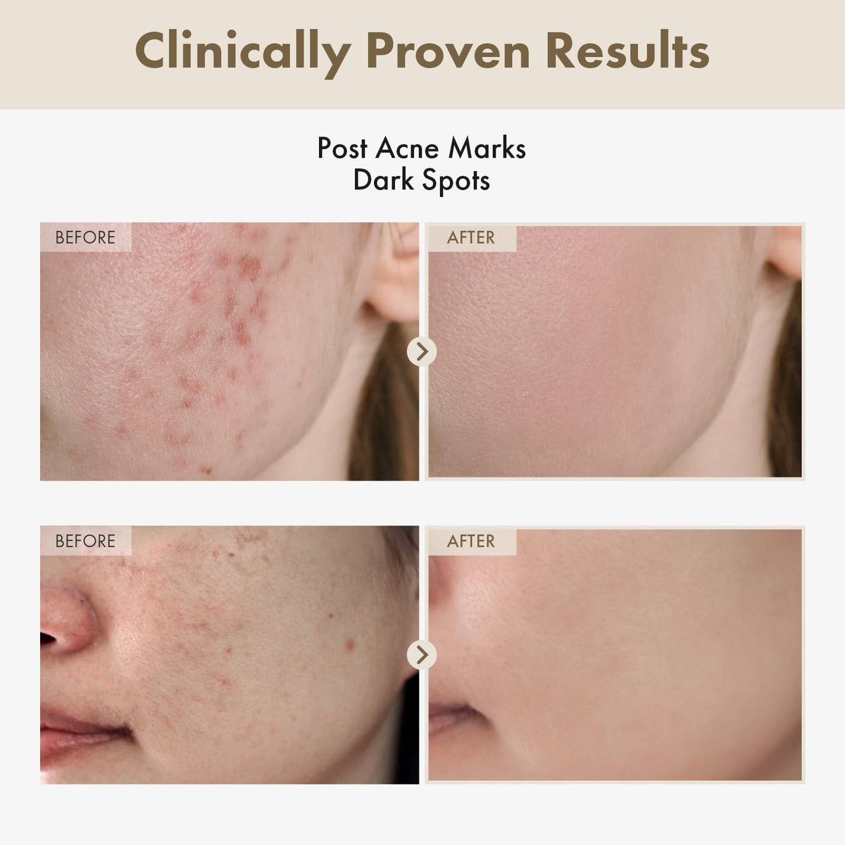 TOSOWOONG K Beauty Hydration Duo Collagen Cream and Rice - TOSOWOONG Official Imagery - 7