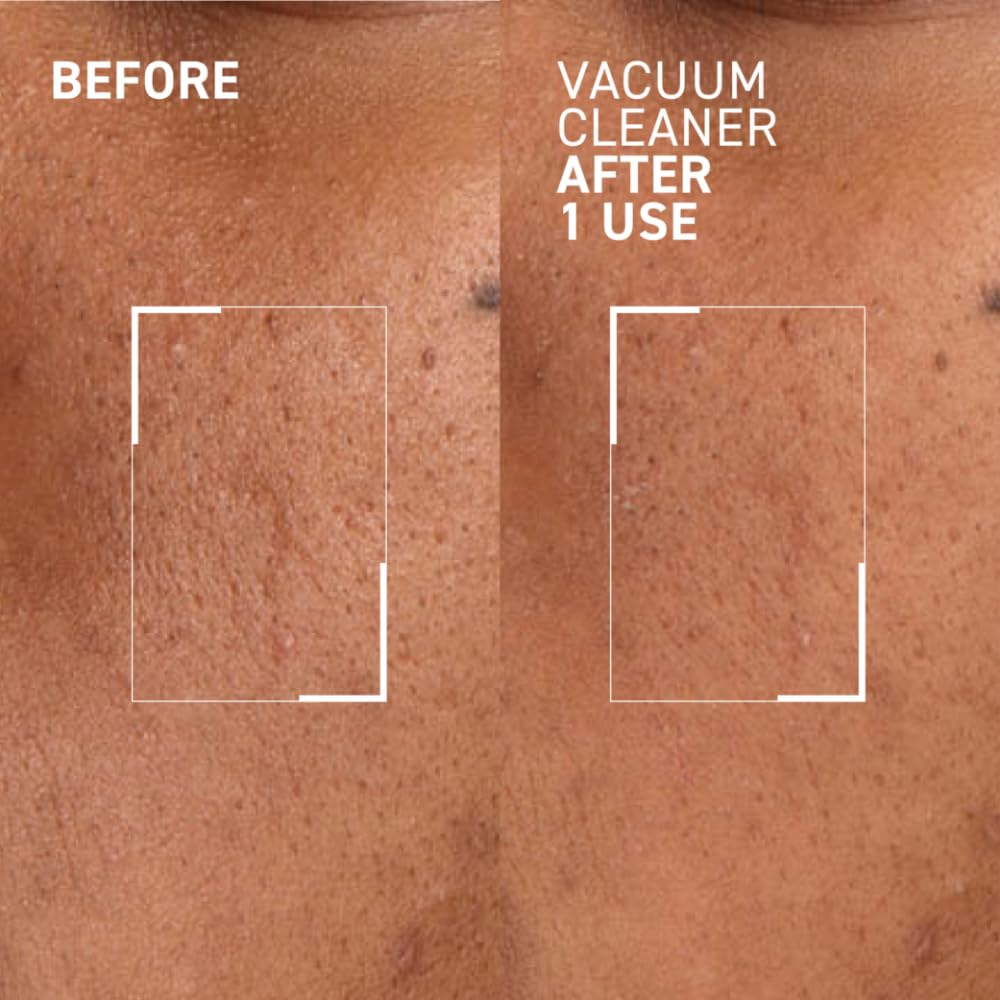 Dr. Brandt Pores No More Vacuum Cleaner pore-purifying mask in a white jar with black lid, designed for deep cleansing.