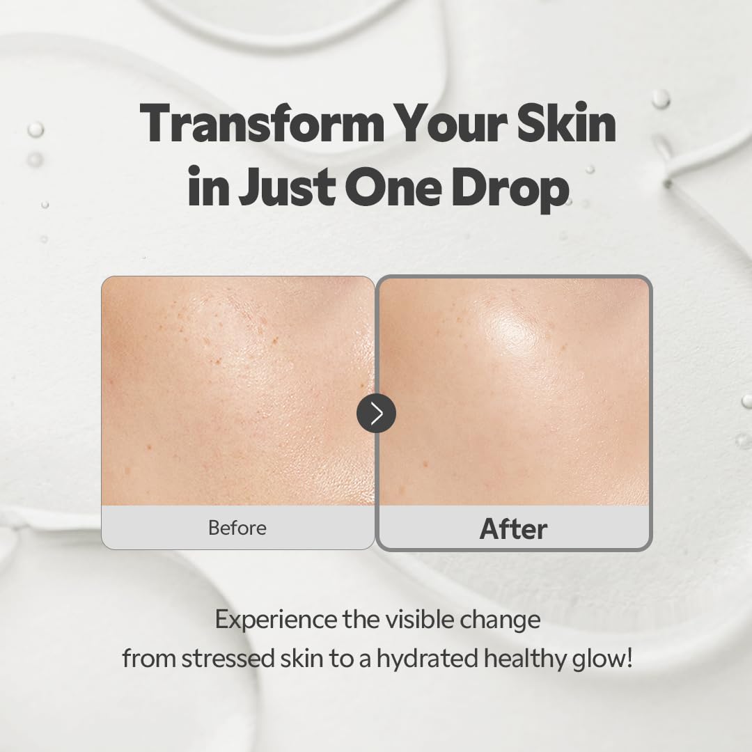 TIRTIR SOS Serum - TIRTIR