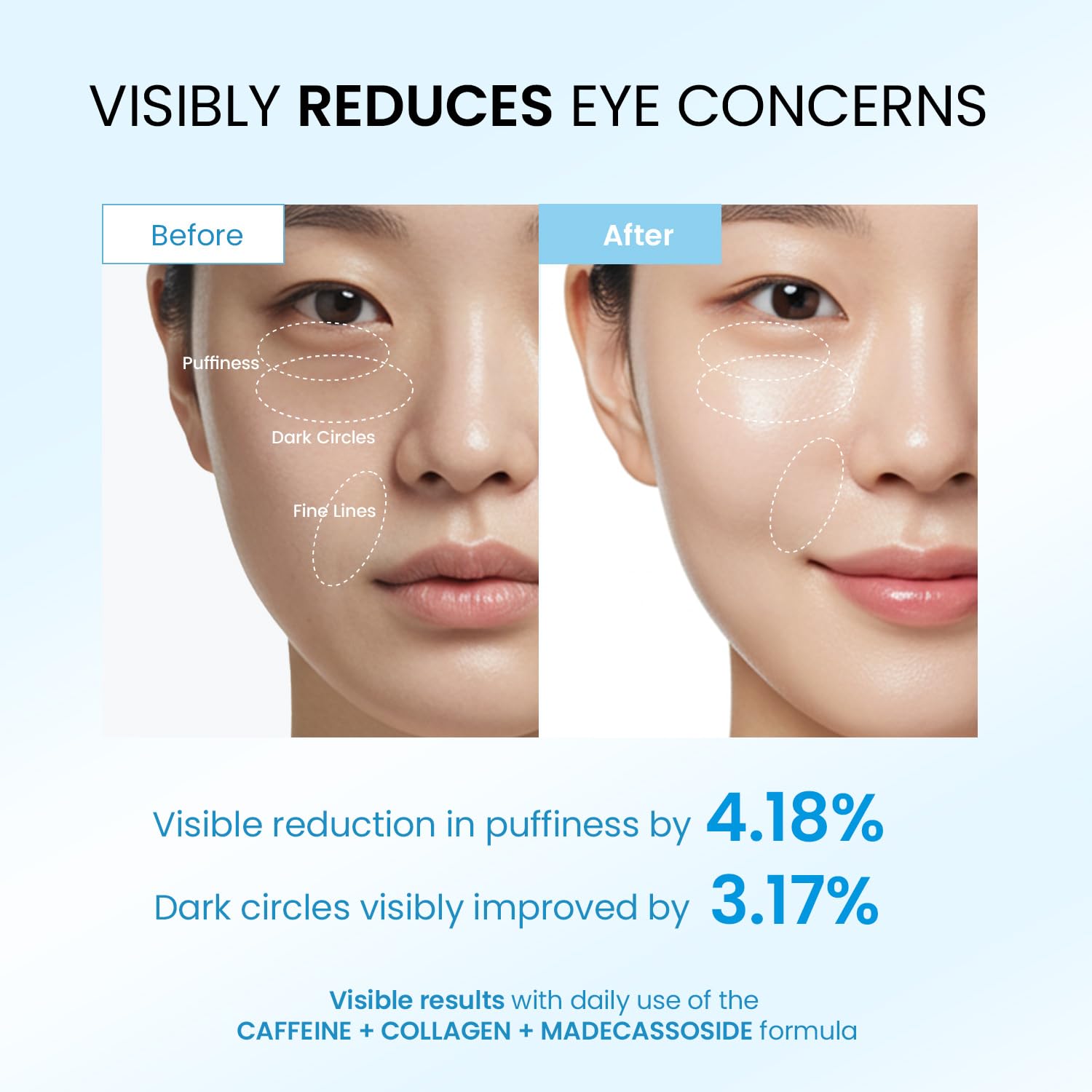 Dongyu Caffeine Under Eye Cream Anti Aging Firming Collagen - Dongyu Official Product Imagery - 3