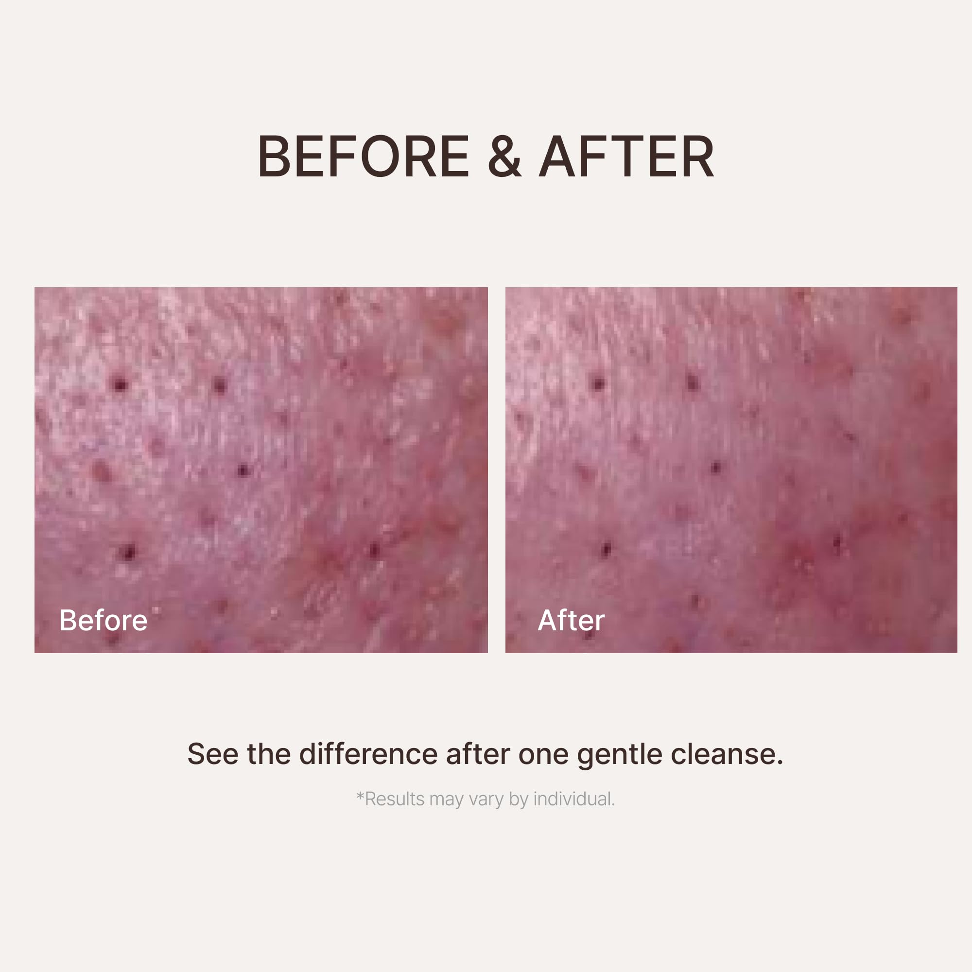 Alkalescent Aloe Cleansing Foam, Deep Cleansing Foam, Blackhead - ChungMiJung