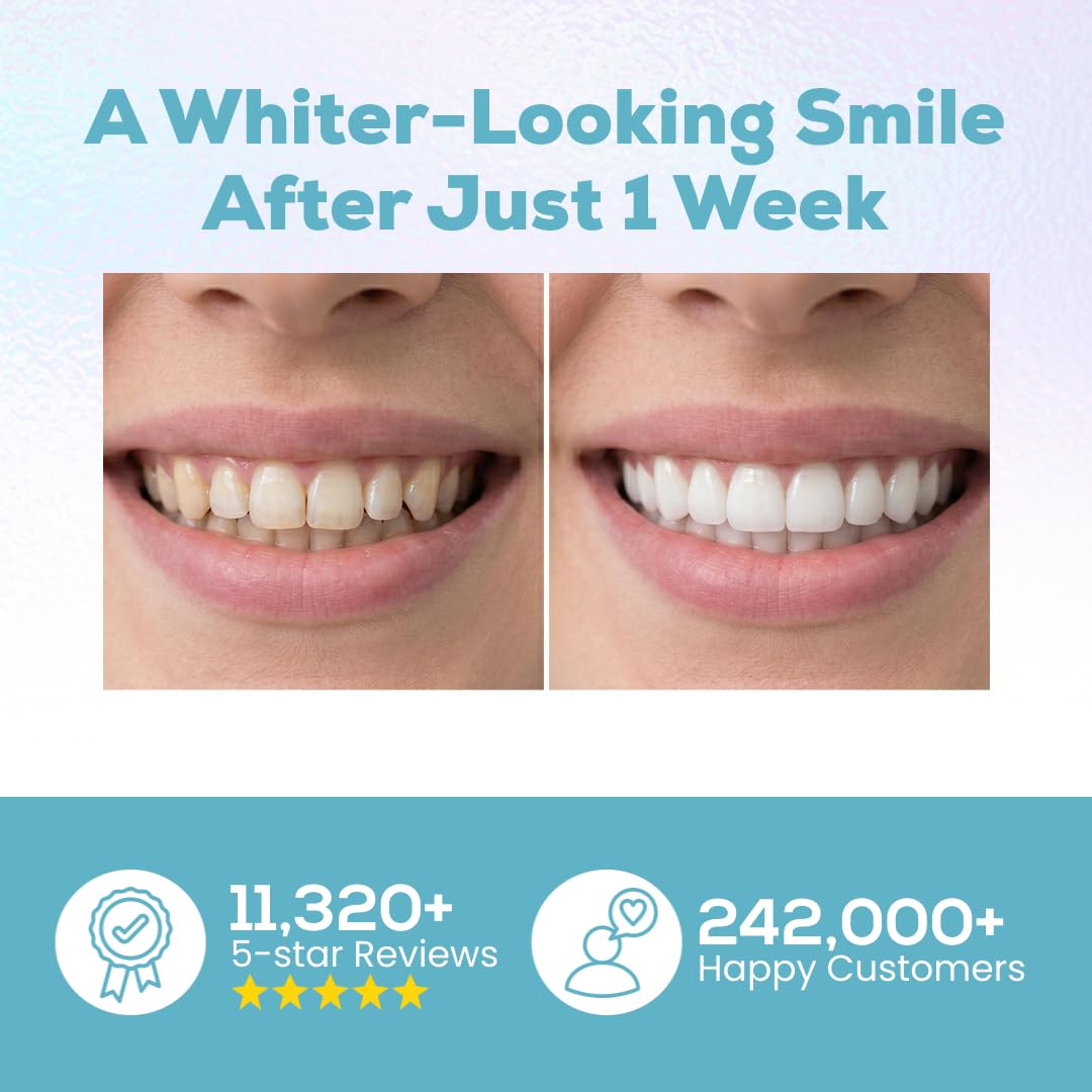 Venus Visage Teeth Whitening Pen and Tooth Polishing Kit   – Professio - View 2