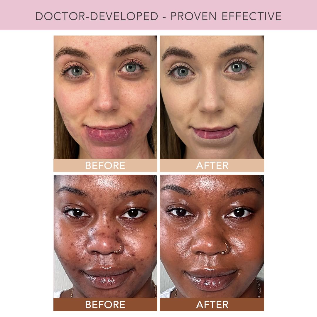 Doll 10 TCE Liquid Filter CC Cream - DOLL 10 Official Imagery - 7