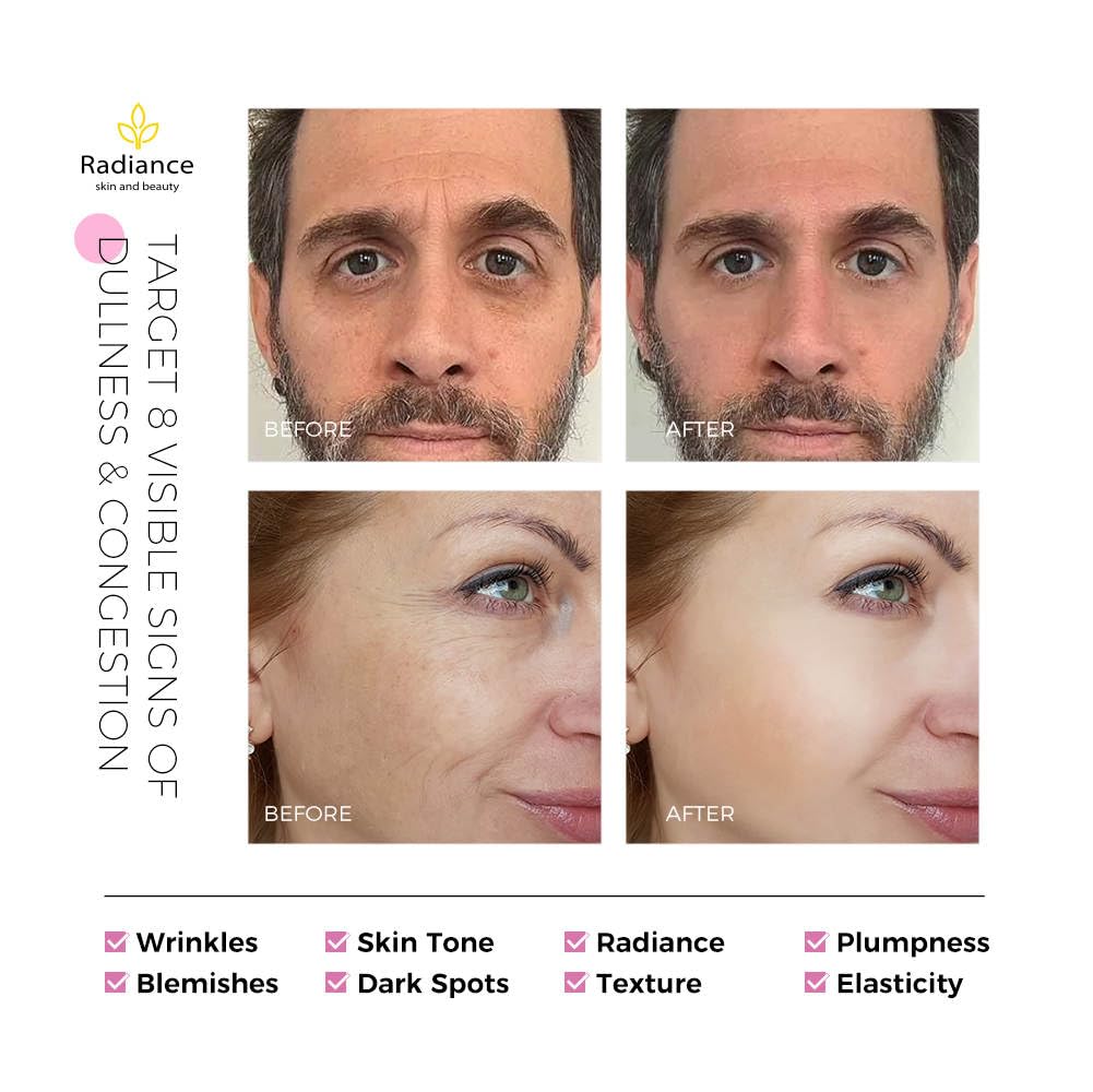 RADIANCE - Retinol Serum for Face with Vitamin E - Generic Official Product View 7