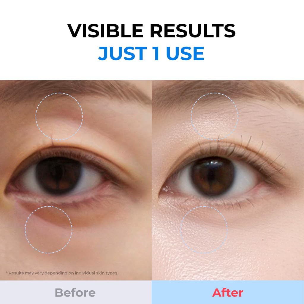 DEWYCEL BabyCollagen Hydro Gel Mask - DEWYCEL