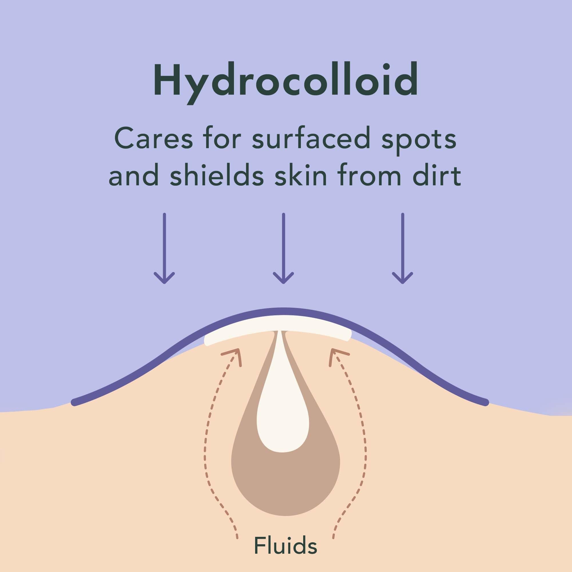 Rael Miracle Spot Control Cover Hydrocolloid Strips Pimple - Rael
