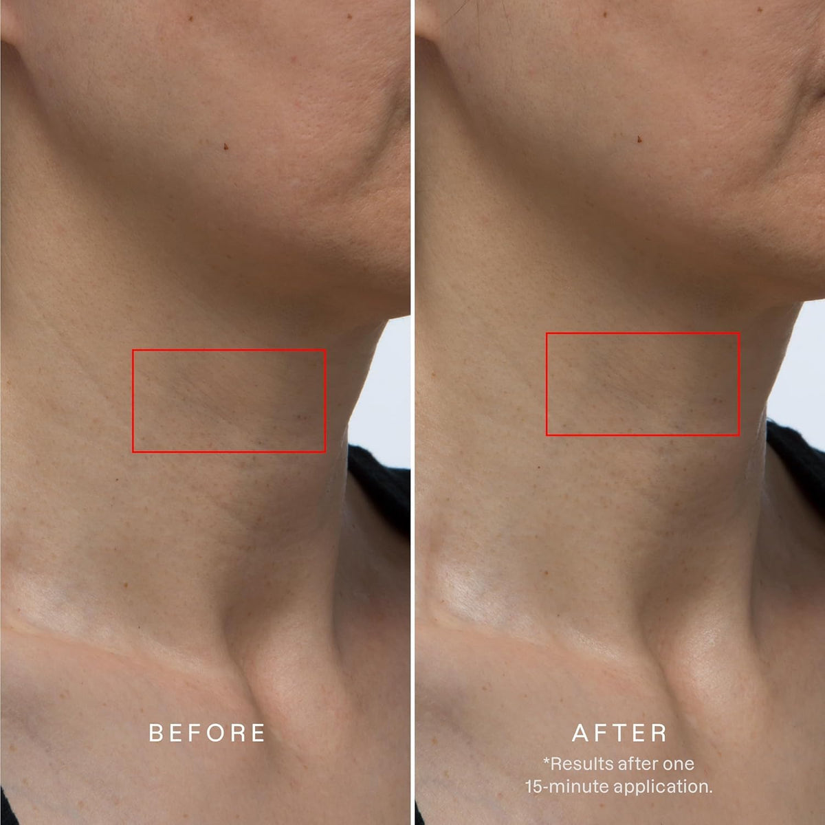 Karuna Collagen Hydrogel Neck Mask 4 Pack - Karuna Official Imagery - 3