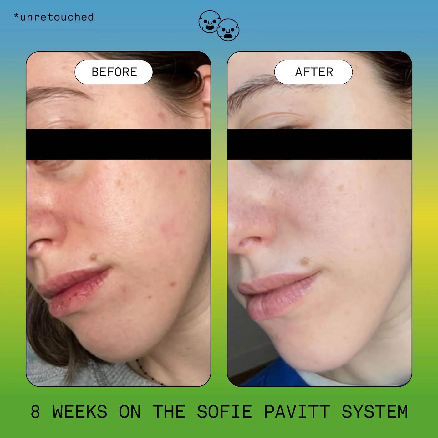 SOFIE PAVITT FACE The Skin School Set: Cleanse, Treat &amp; - Generic