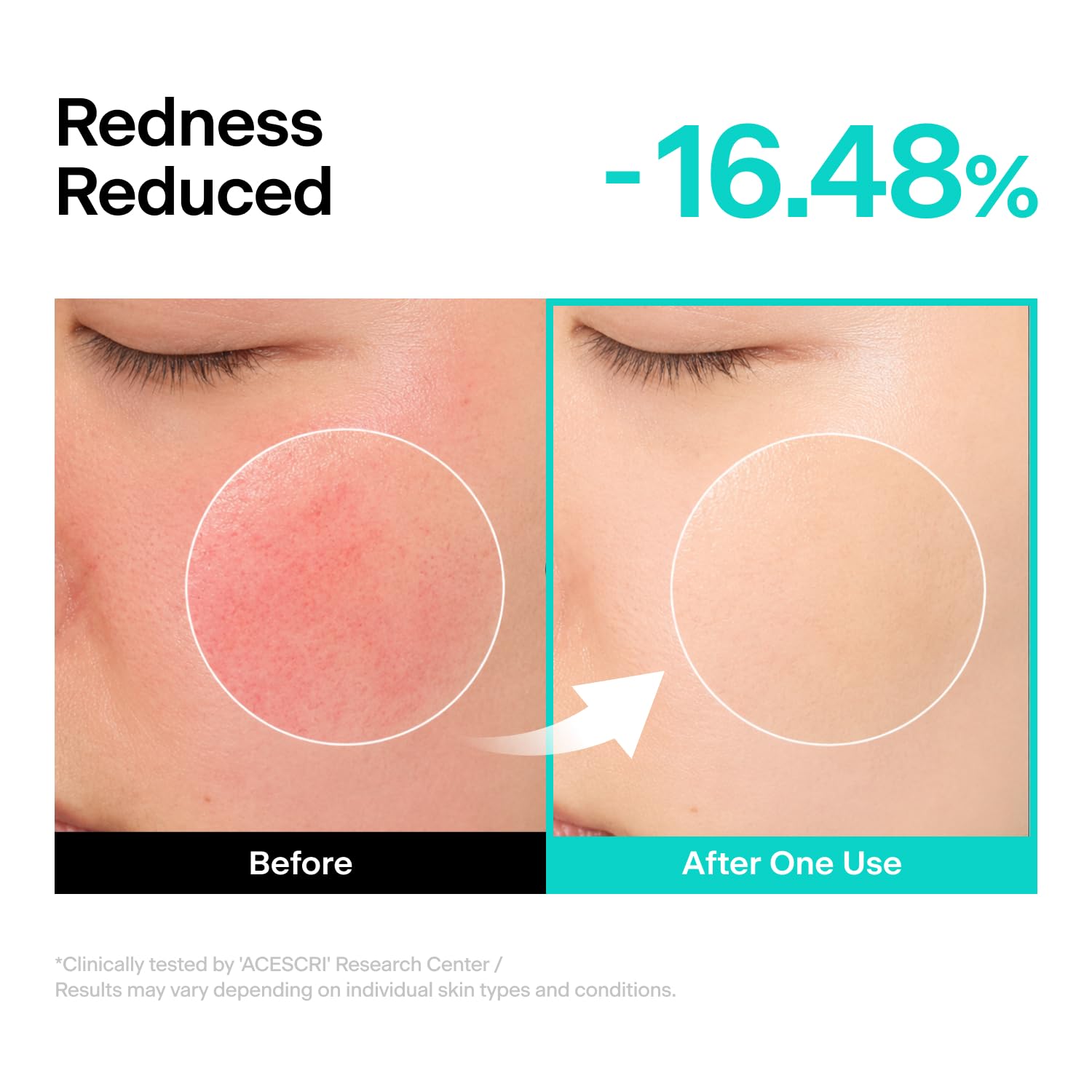 PPM 30 000 Relief Cream PDRN Panthenol Madecassoside - THOME Official Imagery - 6