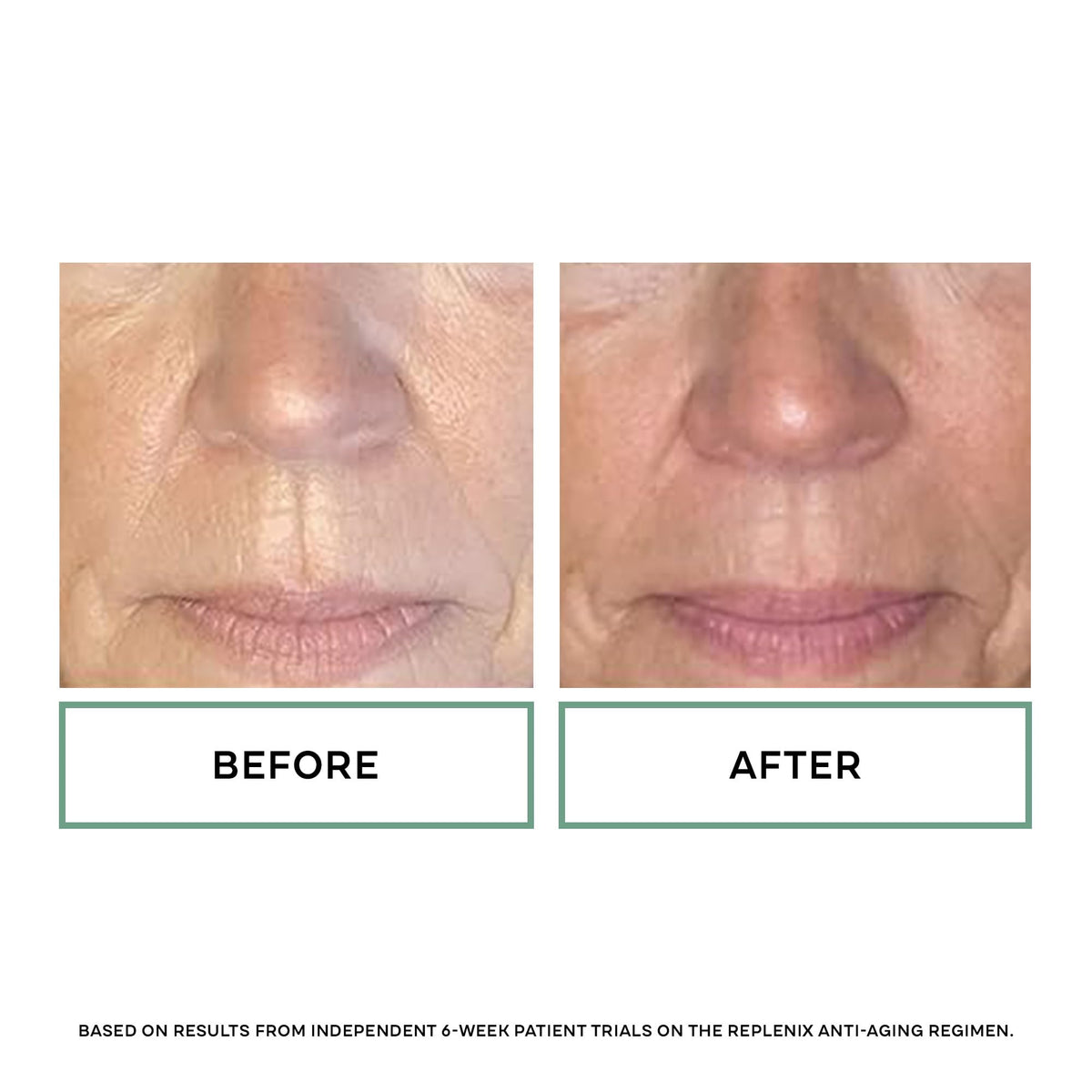 Replenix Glycolic Acid 20 Resurfacing Cream Hydrating - Replenix Official Imagery - 6
