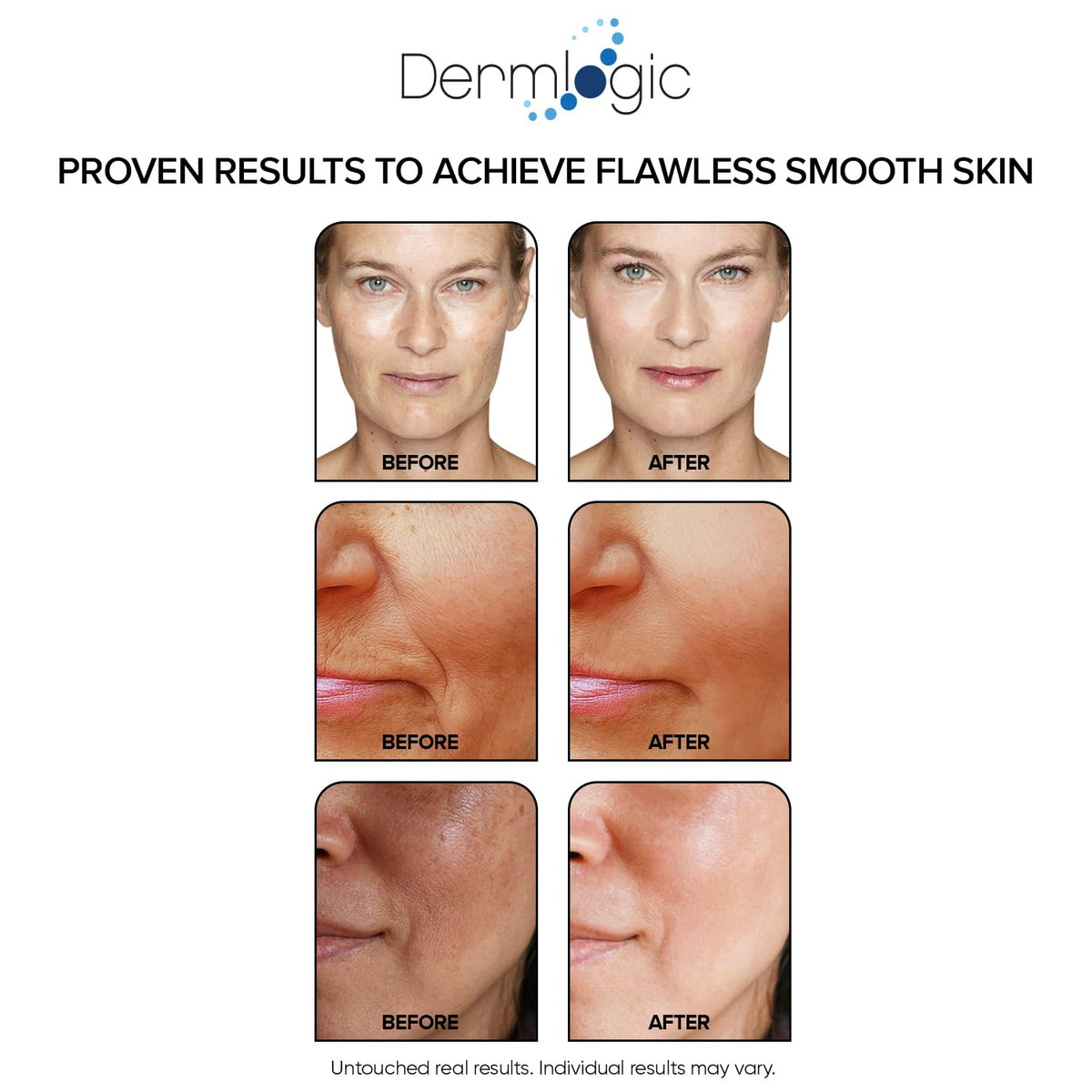 Dermlogic Anti-Aging Resurfacing Peel Pads for facial skin with triple action chemical peel, showing the product in a sleek container.