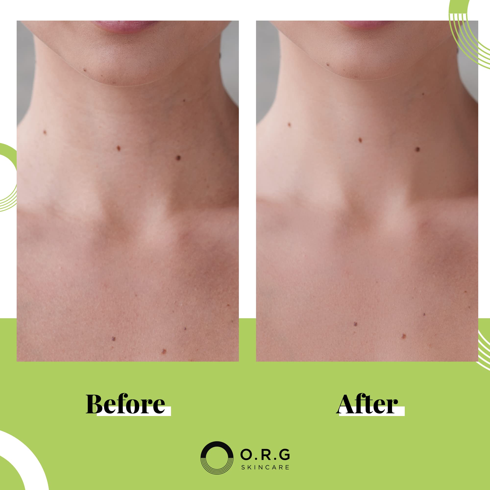 O.R.G. Skincare O.R.G Skincare Mineral Peel Body Exfoliator - Beauty Body Peel - O.R.G. Skincare Official Product View 3
