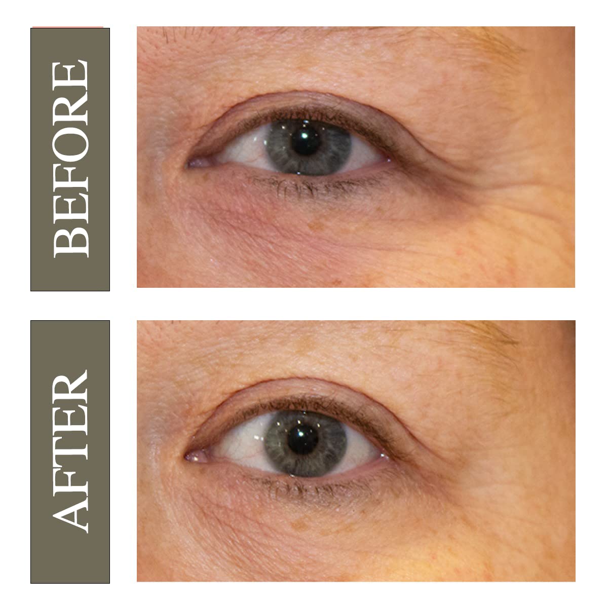 Hey Honey Open Your Eyes Lifting Eye Serum - Hey Honey Official Imagery - 4
