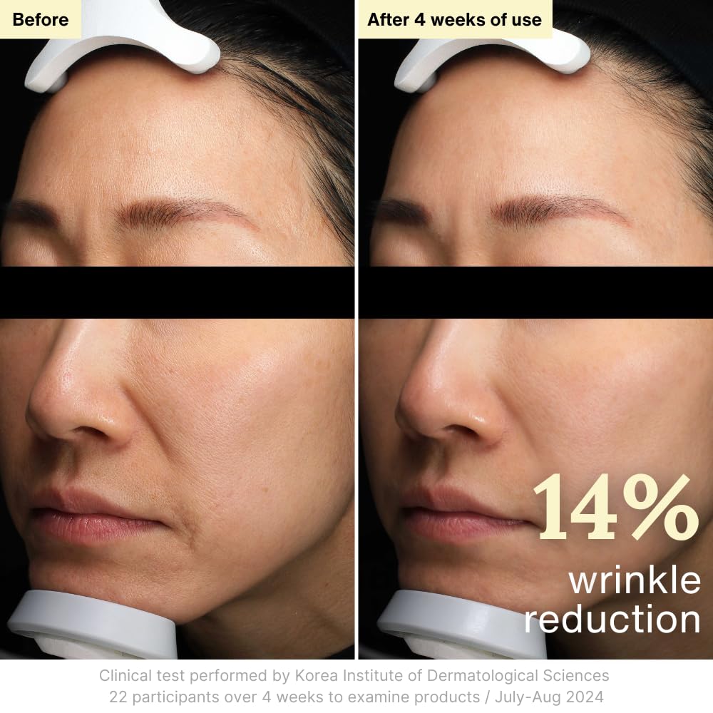 Resilience Cream Anti Aging with Bakuchiol 10 000ppm Face - Rothea Official Imagery - 5