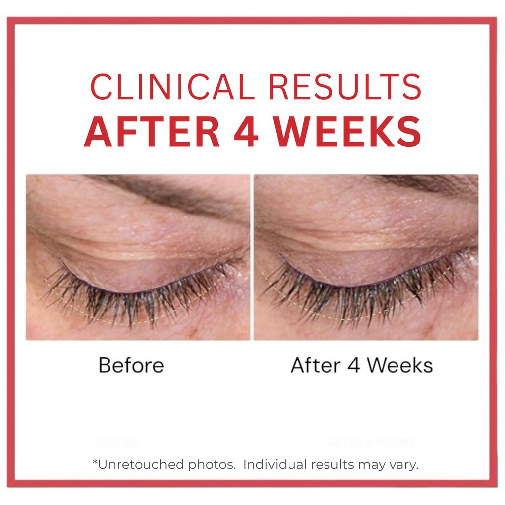 Consult Beaute Copperum 29 Rejuvenating Eye Treatment - Consult Beaute Official Imagery - 5