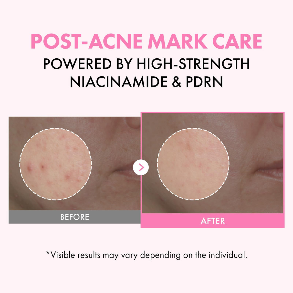 TOSOWOONG Double PDRN Glow Bundle Hydrating Pink Niacinamide - TOSOWOONG Official Imagery - 4