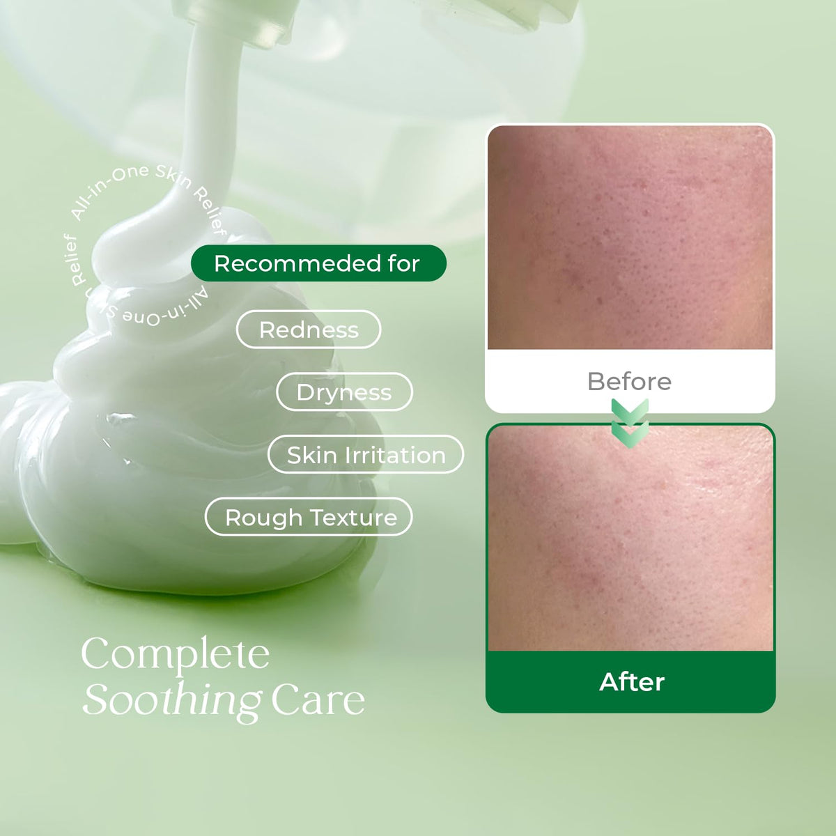PDRN Aloe Moisture Barrier Cream 100ml 3 38 fl oz - FARMIC Official Imagery - 8