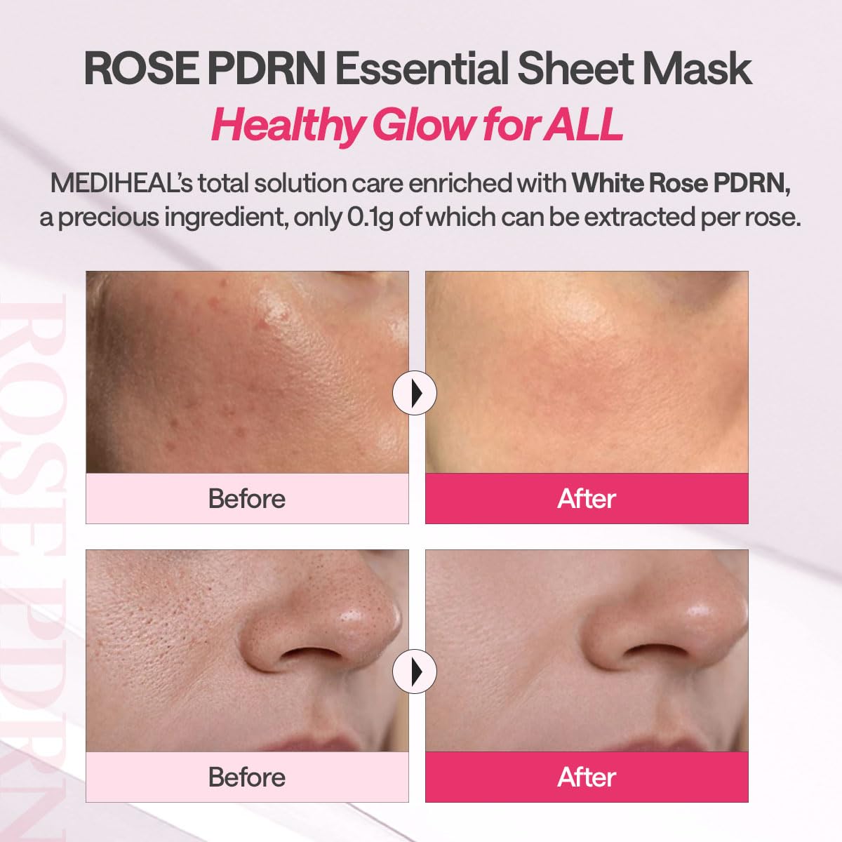 MEDIHEAL Rose PDRN Essential Face Sheet Mask, Healthy Glow (10ea) - MEDIHEAL Official Product View 6