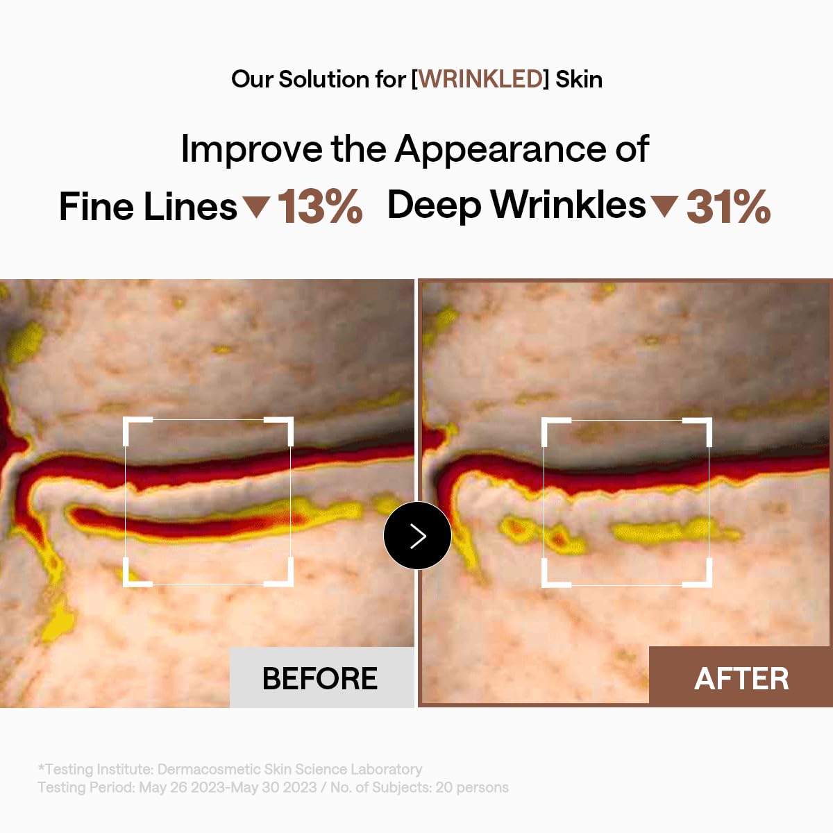 MEDIHEAL 95% Retinol & Collagen Under Eye Patches, Wrinkle Car... - MEDIHEAL Official Product View 6
