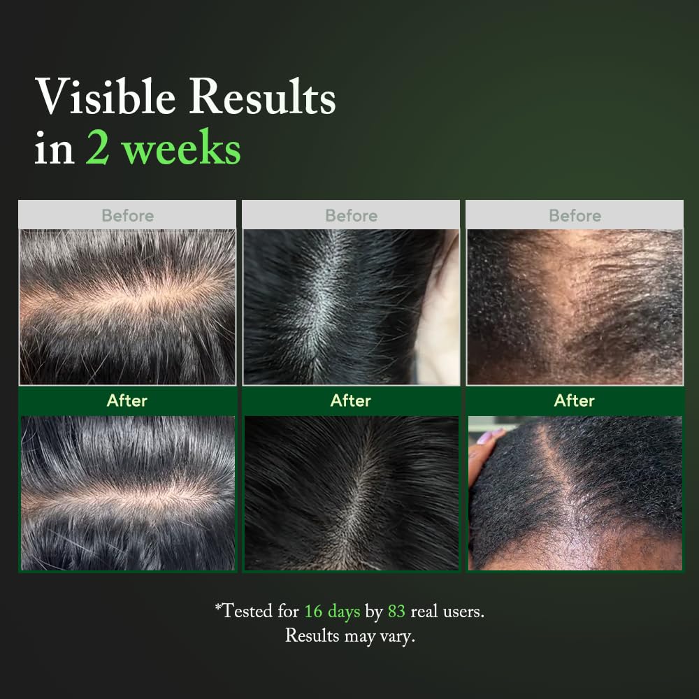 AROMATICA Overnight Rosemary PDRN Scalp Serum for Scalp Treatment - AROMATICA Official Product View 5