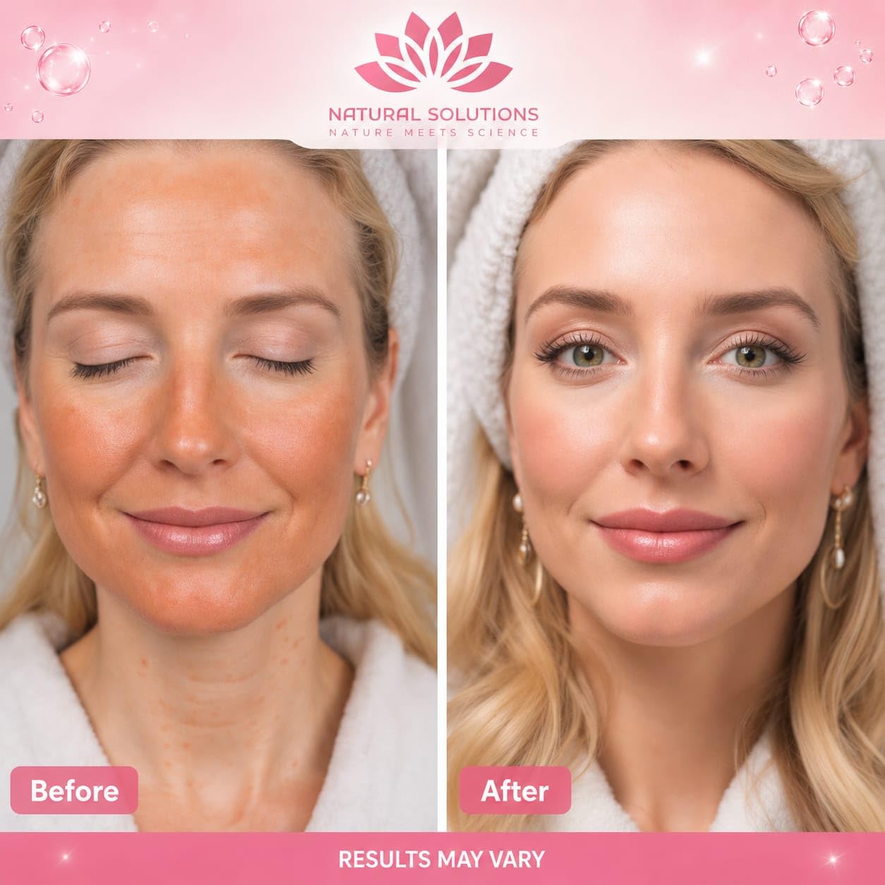 Korean Salmon DNA PDRN Pink Serum, Hyaluronic Acid, Peptides, - Natural Solutions Nature Meets Science