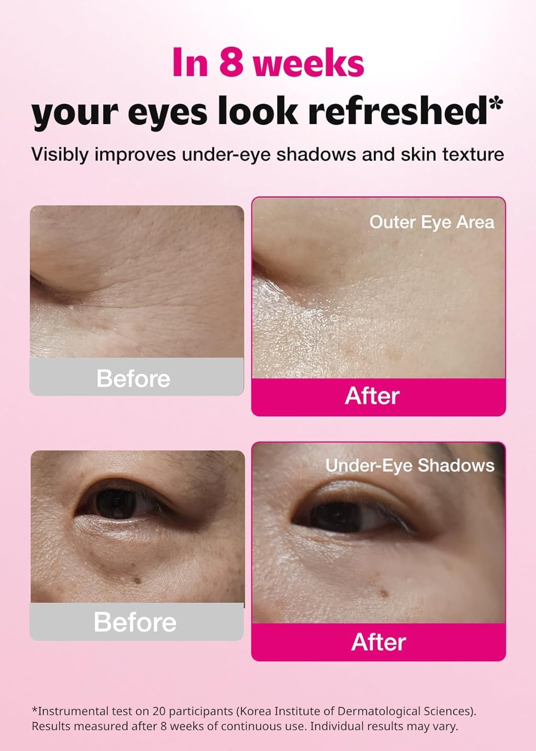 ISOI Blemish Care Eye Patches with Hyaluronic Acid, 90 Count - ISOI Official Product View 4