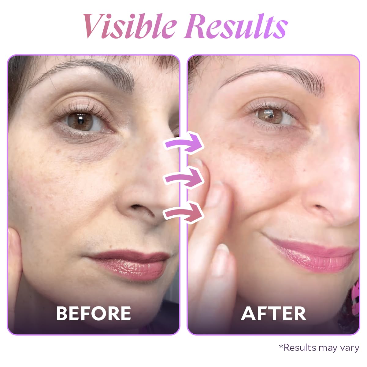 Fi ra Bakuchiol Rejuvenating Facial Treatment - FIÈRA Official Imagery - 6