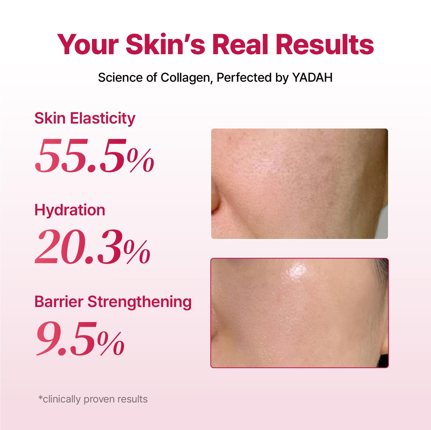 YADAH Collagen Hydra Core Cream 1 76 oz 50g Deep Hydration - YADAH Official Imagery - 5
