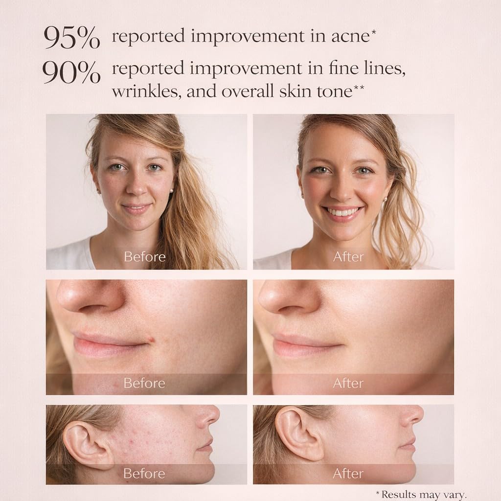 Aphrona Halo Led Face Mask Led Light Therapy for face Facial - Aphrona Official Imagery - 5