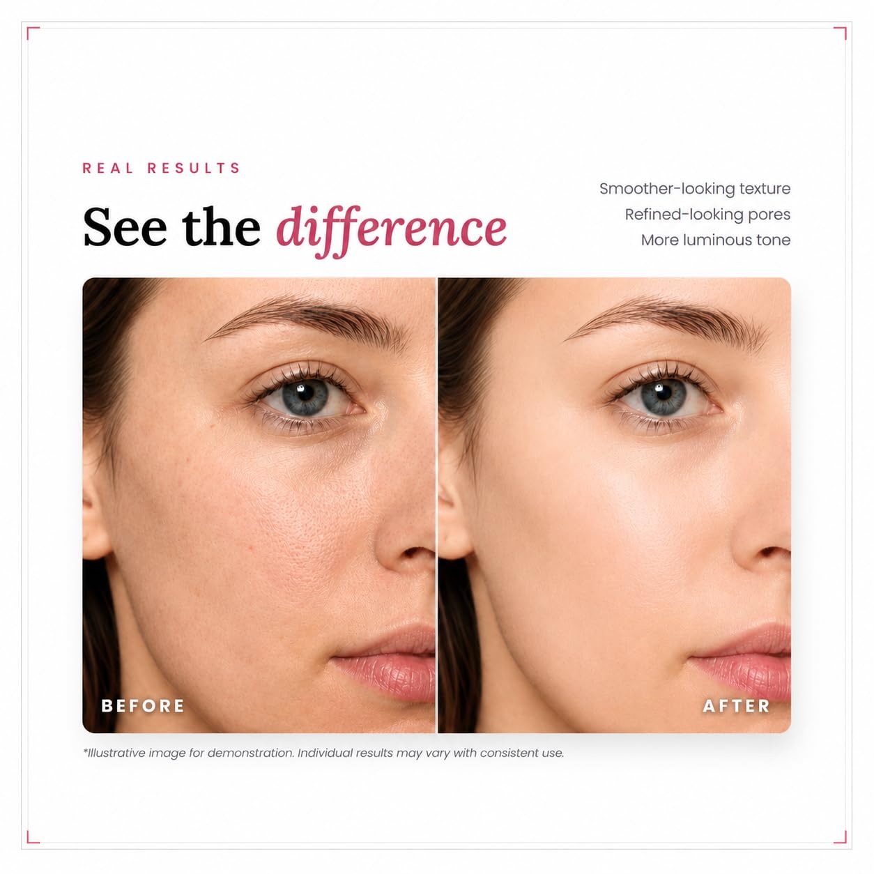Collagen Niacinamide Serum, For Discoloration/Minimizing Large - Cledbel
