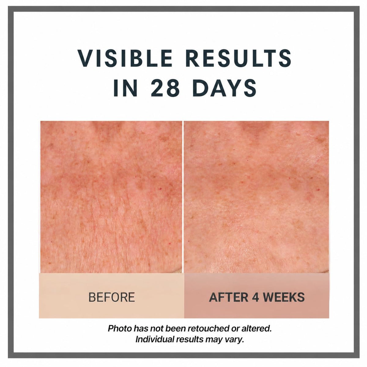 Consult Beaute Champagne Lift Hydrating Firming Body Cream - Consult Beaute Official Imagery - 7