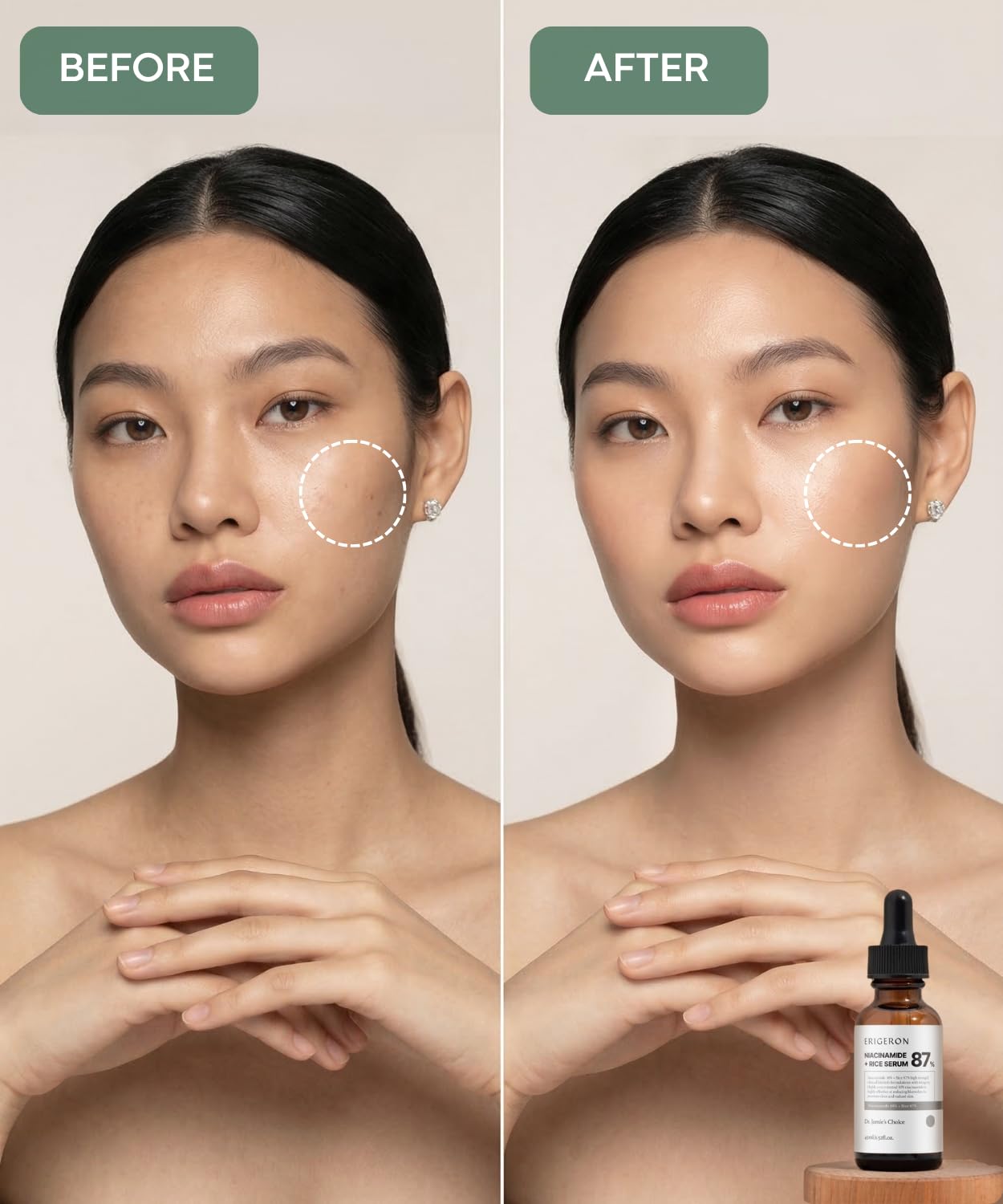 Rice Serum 87% with 10% Niacinamide – Korean Skincare for Pores, - erigeron