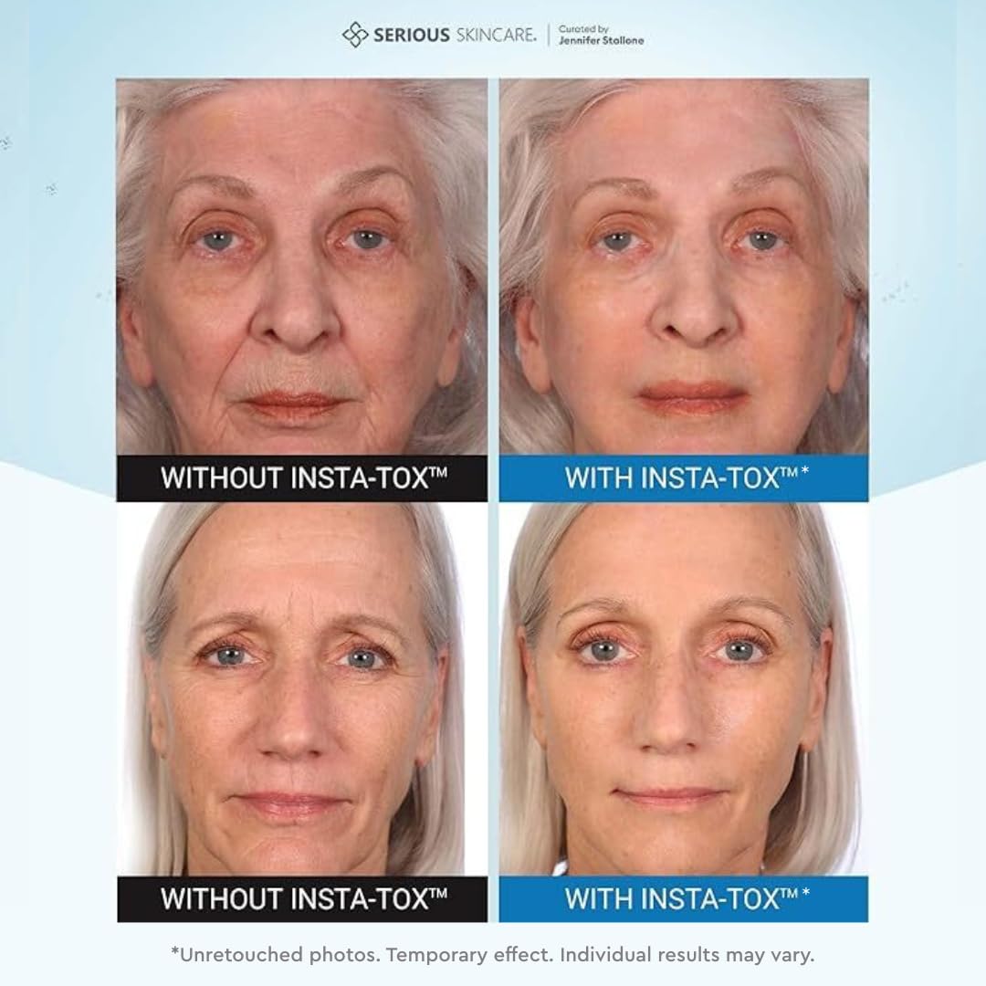 Serious Skincare INSTA TOX Instant Wrinkle Filler Face Serum - Serious Skincare Official Imagery - 4