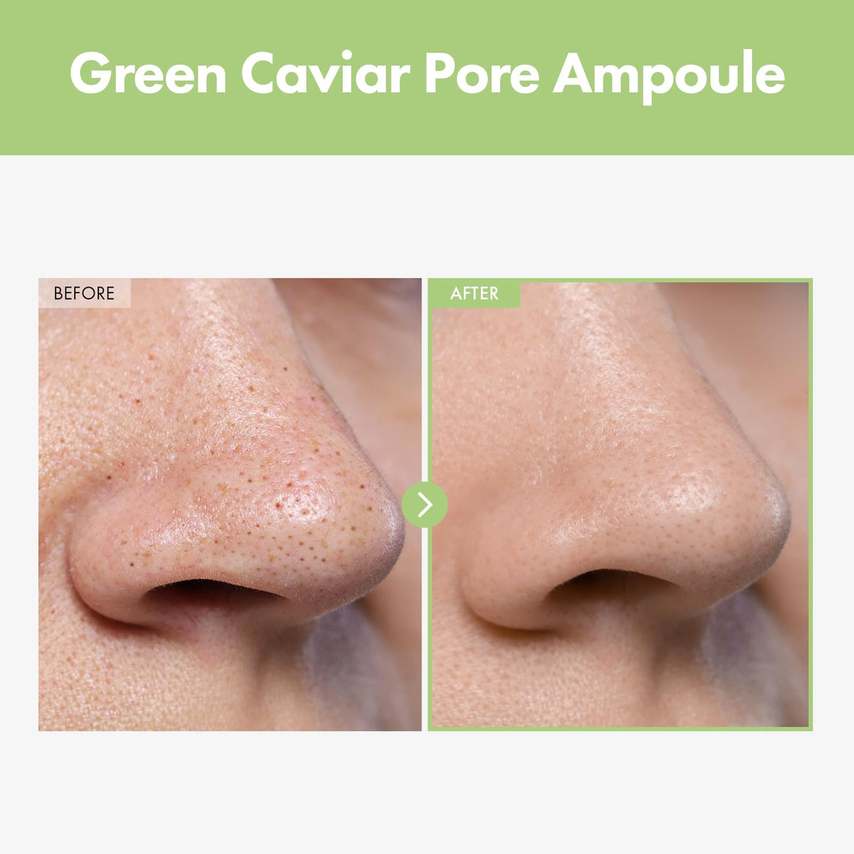 TOSOWOONG Green Caviar Pore Ampoule for Pore Care Firming - TOSOWOONG Official Imagery - 3