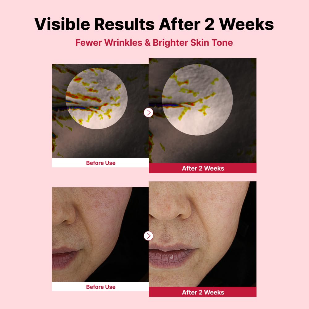 NIDA Youthful Formula™ Yam Mucin ABCE Facial Cream - Wild Yam Root Extract & - NIDA Official Product View 5