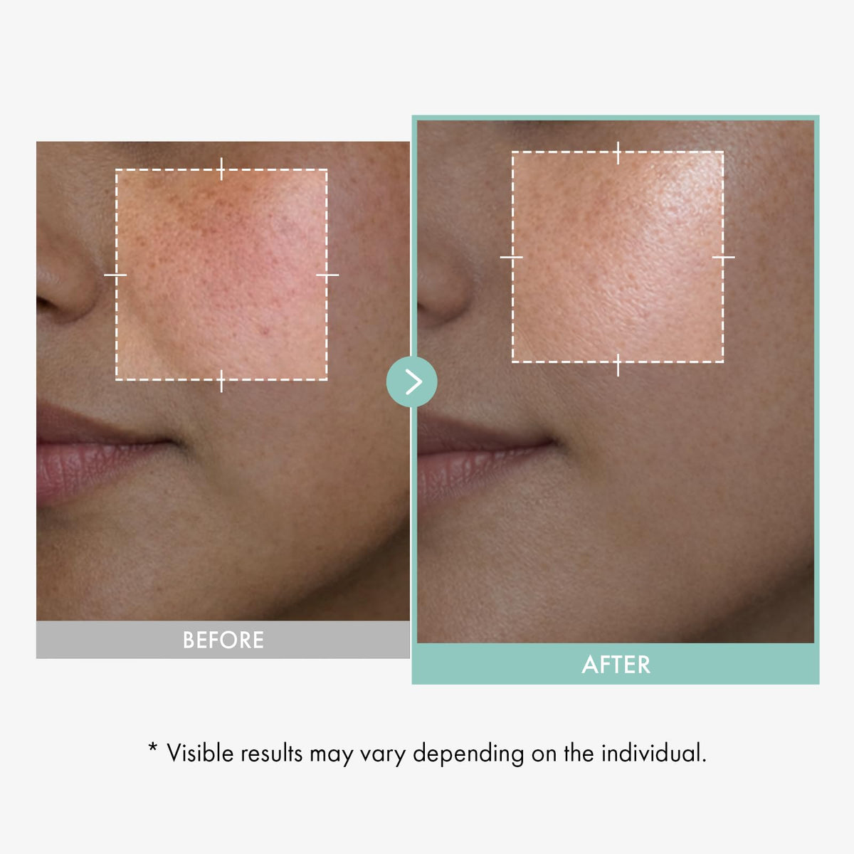 TOSOWOONG Glycolic Acid 10 AHA Exfoliating Serum for Dark - TOSOWOONG Official Imagery - 4