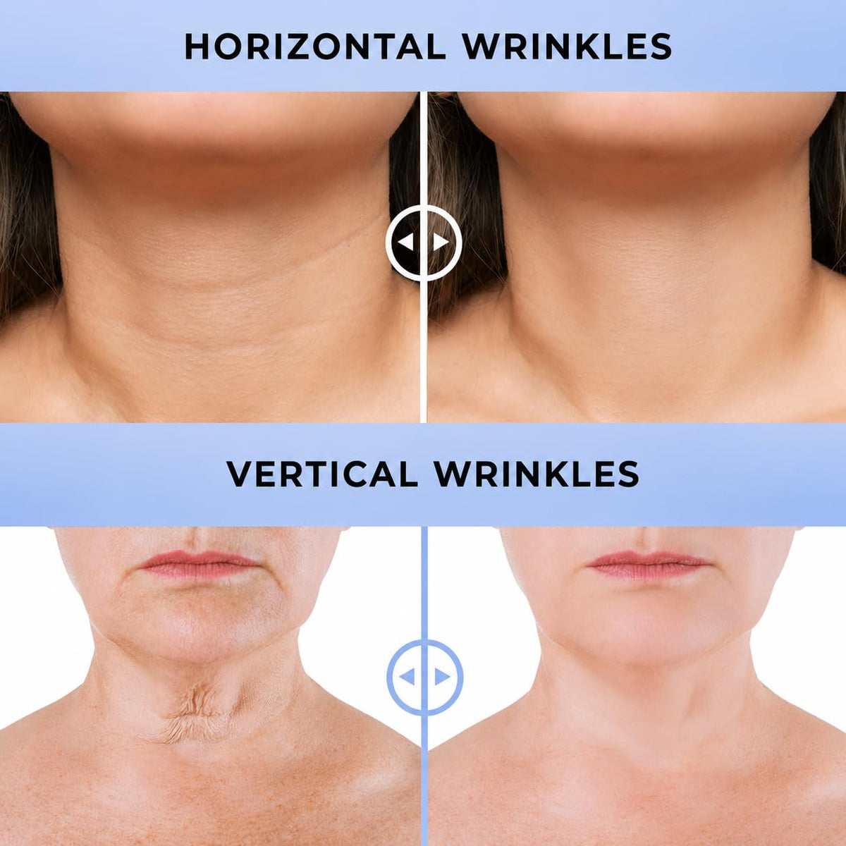 Advanced Neck Cream for Tightening and Firming - DERPHEA Official Imagery - 7