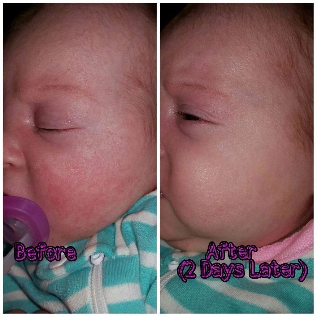 BabyBiotics - SIANI Official Imagery - 3