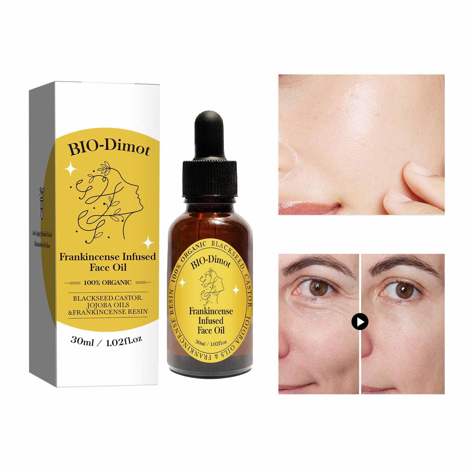 GHTPJ Frankincense Resin Oil, With Organic Jojoba and Castor Oil Cold Pressed - GHTPJ Official Product View 3