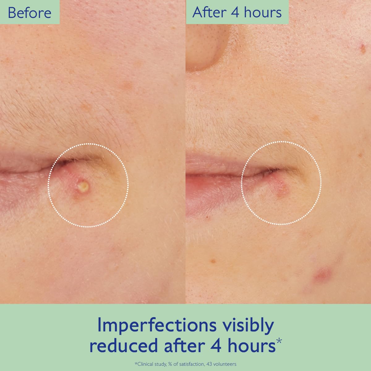 Caudalie Vinopure Targeted Spot Solution with Salicylic Acid - Caudalie Official Imagery - 4